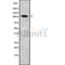 DF8765 at 1/100 staining Mouse lung tissue by IHC-P. The sample was formaldehyde fixed and a heat mediated antigen retrieval step in citrate buffer was performed. The sample was then blocked and incubated with the antibody for 1.5 hours at 22¡ãC. An HRP conjugated goat anti-rabbit antibody was used as the secondary