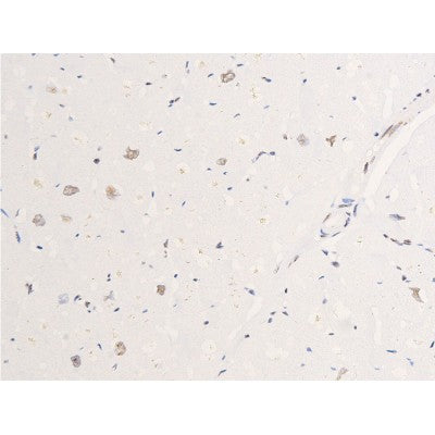 AF3050 staining SK-OV3 by IF/ICC. The sample were fixed with PFA and permeabilized in 0.1% Triton X-100,then blocked in 10% serum for 45 minutes at 25¡ãC. The primary antibody was diluted at 1/200 and incubated with the sample for 1 hour at 37¡ãC. An  Alexa Fluor 594 conjugated goat anti-rabbit IgG (H+L) Ab, diluted at 1/600, was used as the secondary antibod