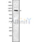 Western blot analysis of RECK using Jurkat whole cell lysates