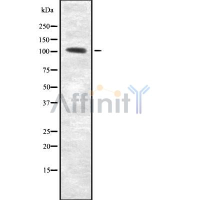 Western blot analysis of RECK using Jurkat whole cell lysates