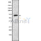 Western blot analysis of extracts from MCF7, using KITH_HHV11 Antibody. The lane on the left was treated with blocking peptide.