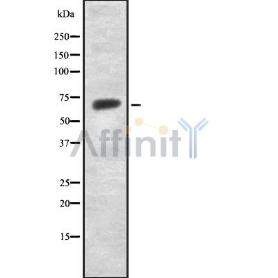 Western blot analysis of extracts from MCF7, using KITH_HHV11 Antibody. The lane on the left was treated with blocking peptide.