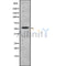 Western blot analysis of extracts from B16F10, using KR2_HHV11 Antibody. The lane on the left was treated with blocking peptide.