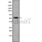 Western blot analysis of extracts from HepG2, using KR1_HHV11 Antibody. The lane on the left was treated with blocking peptide.