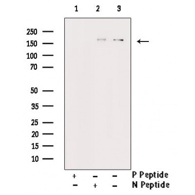 AF3051 staining SK-OV3 by IF/ICC. The sample were fixed with PFA and permeabilized in 0.1% Triton X-100,then blocked in 10% serum for 45 minutes at 25¡ãC. The primary antibody was diluted at 1/200 and incubated with the sample for 1 hour at 37¡ãC. An  Alexa Fluor 594 conjugated goat anti-rabbit IgG (H+L) Ab, diluted at 1/600, was used as the secondary antibod