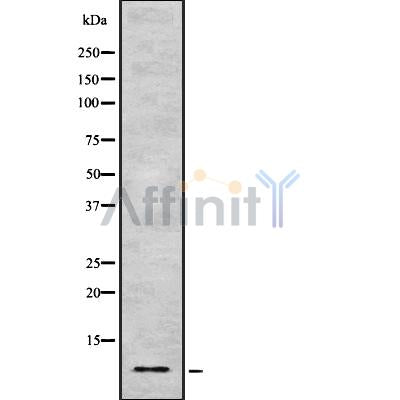 Western blot analysis of HMG14 using Jurkat whole cell lysates
