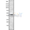 DF8778 staining HuvEc/RAW by IF/ICC. The sample were fixed with PFA and permeabilized in 0.1% Triton X-100,then blocked in 10% serum for 45 minutes at 25¡ãC. The primary antibody was diluted at 1/200 and incubated with the sample for 1 hour at 37¡ãC. An  Alexa Fluor 594 conjugated goat anti-rabbit IgG (H+L) Ab, diluted at 1/600, was used as the secondary antibod