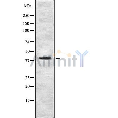 DF8778 staining HuvEc/RAW by IF/ICC. The sample were fixed with PFA and permeabilized in 0.1% Triton X-100,then blocked in 10% serum for 45 minutes at 25¡ãC. The primary antibody was diluted at 1/200 and incubated with the sample for 1 hour at 37¡ãC. An  Alexa Fluor 594 conjugated goat anti-rabbit IgG (H+L) Ab, diluted at 1/600, was used as the secondary antibod