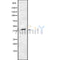 DF8779 staining HepG2 by IF/ICC. The sample were fixed with PFA and permeabilized in 0.1% Triton X-100,then blocked in 10% serum for 45 minutes at 25¡ãC. The primary antibody was diluted at 1/200 and incubated with the sample for 1 hour at 37¡ãC. An  Alexa Fluor 594 conjugated goat anti-rabbit IgG (H+L) Ab, diluted at 1/600, was used as the secondary antibod