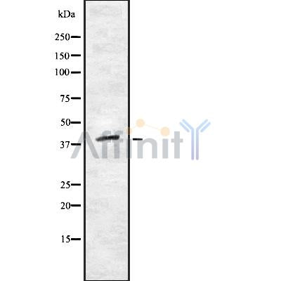 DF8779 staining HepG2 by IF/ICC. The sample were fixed with PFA and permeabilized in 0.1% Triton X-100,then blocked in 10% serum for 45 minutes at 25¡ãC. The primary antibody was diluted at 1/200 and incubated with the sample for 1 hour at 37¡ãC. An  Alexa Fluor 594 conjugated goat anti-rabbit IgG (H+L) Ab, diluted at 1/600, was used as the secondary antibod