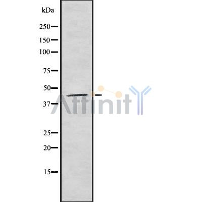 Western blot analysis of KR1_VZVD using mouse brain lysates