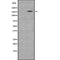 DF8784 at 1/100 staining Human lung tissue by IHC-P. The sample was formaldehyde fixed and a heat mediated antigen retrieval step in citrate buffer was performed. The sample was then blocked and incubated with the antibody for 1.5 hours at 22¡ãC. An HRP conjugated goat anti-rabbit antibody was used as the secondary