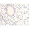 AF3052 staining SK-OV3 by IF/ICC. The sample were fixed with PFA and permeabilized in 0.1% Triton X-100,then blocked in 10% serum for 45 minutes at 25¡ãC. The primary antibody was diluted at 1/200 and incubated with the sample for 1 hour at 37¡ãC. An  Alexa Fluor 594 conjugated goat anti-rabbit IgG (H+L) Ab, diluted at 1/600, was used as the secondary antibod
