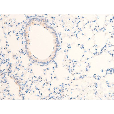AF3052 staining SK-OV3 by IF/ICC. The sample were fixed with PFA and permeabilized in 0.1% Triton X-100,then blocked in 10% serum for 45 minutes at 25¡ãC. The primary antibody was diluted at 1/200 and incubated with the sample for 1 hour at 37¡ãC. An  Alexa Fluor 594 conjugated goat anti-rabbit IgG (H+L) Ab, diluted at 1/600, was used as the secondary antibod