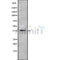 DF8788 staining HepG2 by IF/ICC. The sample were fixed with PFA and permeabilized in 0.1% Triton X-100,then blocked in 10% serum for 45 minutes at 25¡ãC. The primary antibody was diluted at 1/200 and incubated with the sample for 1 hour at 37¡ãC. An  Alexa Fluor 594 conjugated goat anti-rabbit IgG (H+L) Ab, diluted at 1/600, was used as the secondary antibod