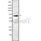 Western blot analysis GCVK_HHV6U using A549 whole cell lysates