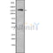 Western blot analysis NKTR using RAW264.7 whole cell lysates