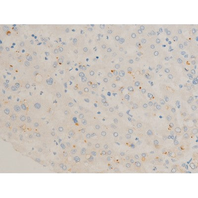 AF3053 staining K562 by IF/ICC. The sample were fixed with PFA and permeabilized in 0.1% Triton X-100,then blocked in 10% serum for 45 minutes at 25¡ãC. The primary antibody was diluted at 1/200 and incubated with the sample for 1 hour at 37¡ãC. An  Alexa Fluor 594 conjugated goat anti-rabbit IgG (H+L) Ab, diluted at 1/600, was used as the secondary antibod