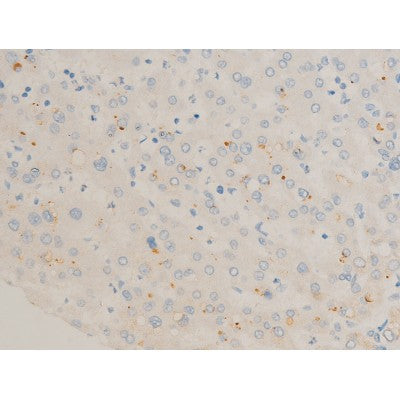 AF3053 staining K562 by IF/ICC. The sample were fixed with PFA and permeabilized in 0.1% Triton X-100,then blocked in 10% serum for 45 minutes at 25¡ãC. The primary antibody was diluted at 1/200 and incubated with the sample for 1 hour at 37¡ãC. An  Alexa Fluor 594 conjugated goat anti-rabbit IgG (H+L) Ab, diluted at 1/600, was used as the secondary antibod