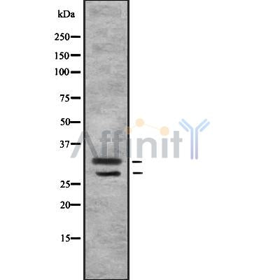 Western blot analysis of MSX1/2 using HuvEc whole cell lysates