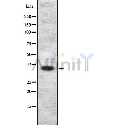 Western blot analysis of MAGEA9 using HuvEc whole cell lysates