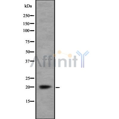 Western blot analysis of MRP using Jurkat whole cell lysates