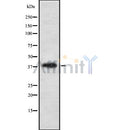 Western blot analysis of VSX2 using NIH-3T3 whole cell lysates