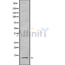 DF8806 at 1/100 staining Rat brain tissue by IHC-P. The sample was formaldehyde fixed and a heat mediated antigen retrieval step in citrate buffer was performed. The sample was then blocked and incubated with the antibody for 1.5 hours at 22¡ãC. An HRP conjugated goat anti-rabbit antibody was used as the secondary