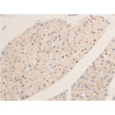 AF3054 staining 293 by IF/ICC. The sample were fixed with PFA and permeabilized in 0.1% Triton X-100,then blocked in 10% serum for 45 minutes at 25¡ãC. The primary antibody was diluted at 1/200 and incubated with the sample for 1 hour at 37¡ãC. An  Alexa Fluor 594 conjugated goat anti-rabbit IgG (H+L) Ab, diluted at 1/600, was used as the secondary antibod