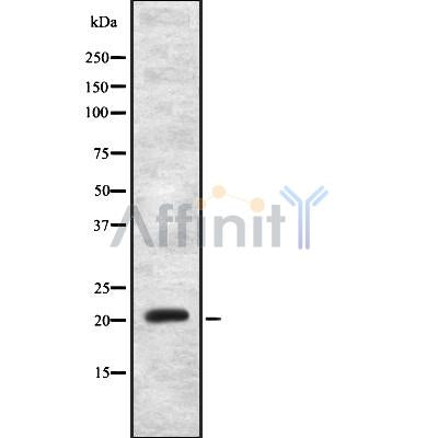Western blot analysis of MRPS11 using MCF7 whole cell lysates