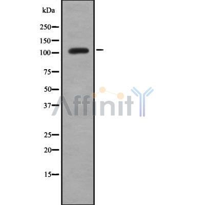 DF8811 at 1/100 staining Mouse lung tissue by IHC-P. The sample was formaldehyde fixed and a heat mediated antigen retrieval step in citrate buffer was performed. The sample was then blocked and incubated with the antibody for 1.5 hours at 22¡ãC. An HRP conjugated goat anti-rabbit antibody was used as the secondary