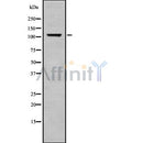 DF8812 at 1/100 staining Human gastric tissue by IHC-P. The sample was formaldehyde fixed and a heat mediated antigen retrieval step in citrate buffer was performed. The sample was then blocked and incubated with the antibody for 1.5 hours at 22¡ãC. An HRP conjugated goat anti-rabbit antibody was used as the secondary