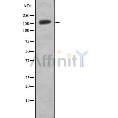 DF8814 at 1/100 staining Mouse spleen tissue by IHC-P. The sample was formaldehyde fixed and a heat mediated antigen retrieval step in citrate buffer was performed. The sample was then blocked and incubated with the antibody for 1.5 hours at 22¡ãC. An HRP conjugated goat anti-rabbit antibody was used as the secondary