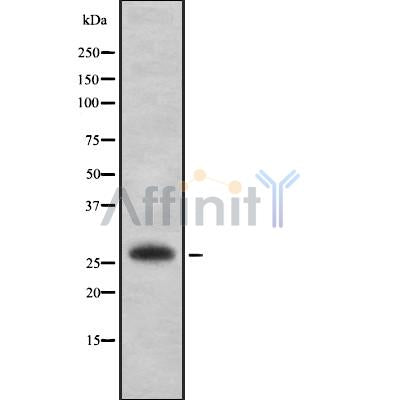 Western blot analysis of EMX2 using K562 whole cell lysates