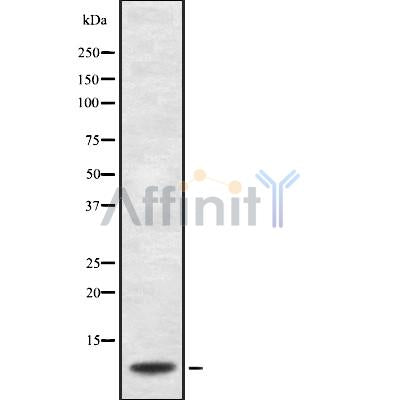 Western blot analysis of extracts from Hybridoma cells, using WIT1 Antibody. The lane on the left was treated with blocking peptide.