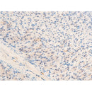 AF3055 staining 293 by IF/ICC. The sample were fixed with PFA and permeabilized in 0.1% Triton X-100,then blocked in 10% serum for 45 minutes at 25¡ãC. The primary antibody was diluted at 1/200 and incubated with the sample for 1 hour at 37¡ãC. An  Alexa Fluor 594 conjugated goat anti-rabbit IgG (H+L) Ab, diluted at 1/600, was used as the secondary antibod