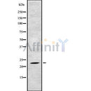 Western blot analysis of TAF10 using Jurkat whole cell lysates