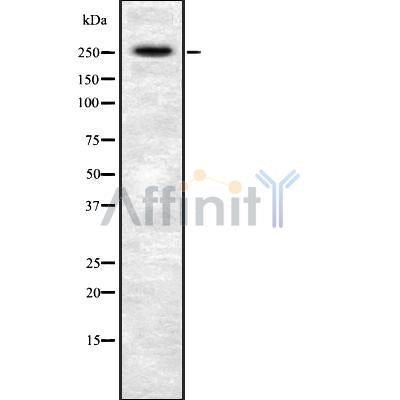 DF8820 at 1/100 staining Mouse muscle tissue by IHC-P. The sample was formaldehyde fixed and a heat mediated antigen retrieval step in citrate buffer was performed. The sample was then blocked and incubated with the antibody for 1.5 hours at 22¡ãC. An HRP conjugated goat anti-rabbit antibody was used as the secondary