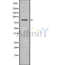 Western blot analysis of extracts from mouse brain, using ZBTB17 Antibody. Lane 1 was treated with the blocking peptide.