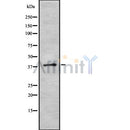 Western blot analysis SFRS6 using HT29 whole cell lysates