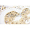 AF3056 staining HeLa by IF/ICC. The sample were fixed with PFA and permeabilized in 0.1% Triton X-100,then blocked in 10% serum for 45 minutes at 25¡ãC. The primary antibody was diluted at 1/200 and incubated with the sample for 1 hour at 37¡ãC. An  Alexa Fluor 594 conjugated goat anti-rabbit IgG (H+L) Ab, diluted at 1/600, was used as the secondary antibod