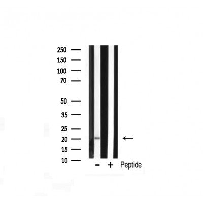 Western blot analysis of JM4 expression in Rat liver lysate
