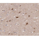 AF0188 at 1/200 staining human brain tissue sections by IHC-P. The tissue was formaldehyde fixed and a heat mediated antigen retrieval step in citrate buffer was performed. The tissue was then blocked and incubated with the antibody for 1.5 hours at 22¡ãC. An HRP conjugated goat anti-rabbit antibody was used as the secondary