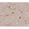 AF0188 at 1/200 staining human brain tissue sections by IHC-P. The tissue was formaldehyde fixed and a heat mediated antigen retrieval step in citrate buffer was performed. The tissue was then blocked and incubated with the antibody for 1.5 hours at 22¡ãC. An HRP conjugated goat anti-rabbit antibody was used as the secondary