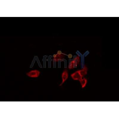 AF0188 staining LOVO by IF/ICC. The sample were fixed with PFA and permeabilized in 0.1% Triton X-100,then blocked in 10% serum for 45 minutes at 25¡ãC. The primary antibody was diluted at 1/200 and incubated with the sample for 1 hour at 37¡ãC. An  Alexa Fluor 594 conjugated goat anti-rabbit IgG (H+L) Ab, diluted at 1/600, was used as the secondary antibod