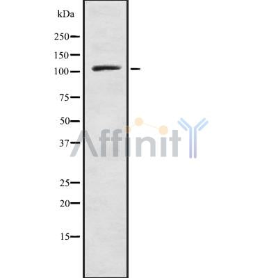 DF8829 at 1/100 staining Human breast cancer tissue by IHC-P. The sample was formaldehyde fixed and a heat mediated antigen retrieval step in citrate buffer was performed. The sample was then blocked and incubated with the antibody for 1.5 hours at 22¡ãC. An HRP conjugated goat anti-rabbit antibody was used as the secondary