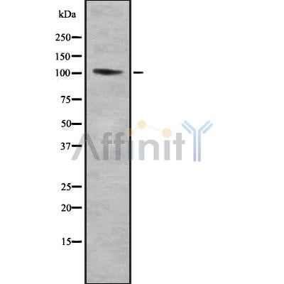 DF8830 at 1/100 staining Rat lung tissue by IHC-P. The sample was formaldehyde fixed and a heat mediated antigen retrieval step in citrate buffer was performed. The sample was then blocked and incubated with the antibody for 1.5 hours at 22¡ãC. An HRP conjugated goat anti-rabbit antibody was used as the secondary