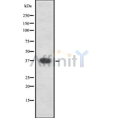 Western blot analysis of extracts from various samples, using hnRNP E1 Antibody.
 Lane 1: B16F10, treated with blocking peptide;
 Lane 2: B16F10;
 Lane 3: Rat  brain.