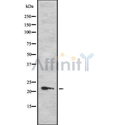 Western blot analysis of TPD52L1 using LOVO whole cell lysates