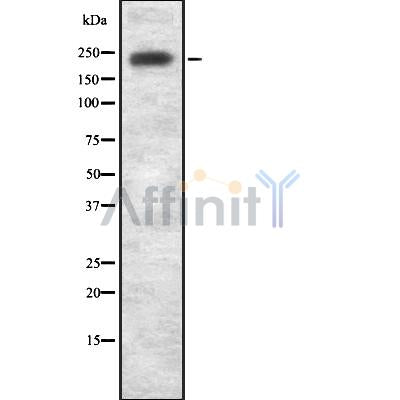 DF8834 at 1/100 staining Human prostate tissue by IHC-P. The sample was formaldehyde fixed and a heat mediated antigen retrieval step in citrate buffer was performed. The sample was then blocked and incubated with the antibody for 1.5 hours at 22¡ãC. An HRP conjugated goat anti-rabbit antibody was used as the secondary